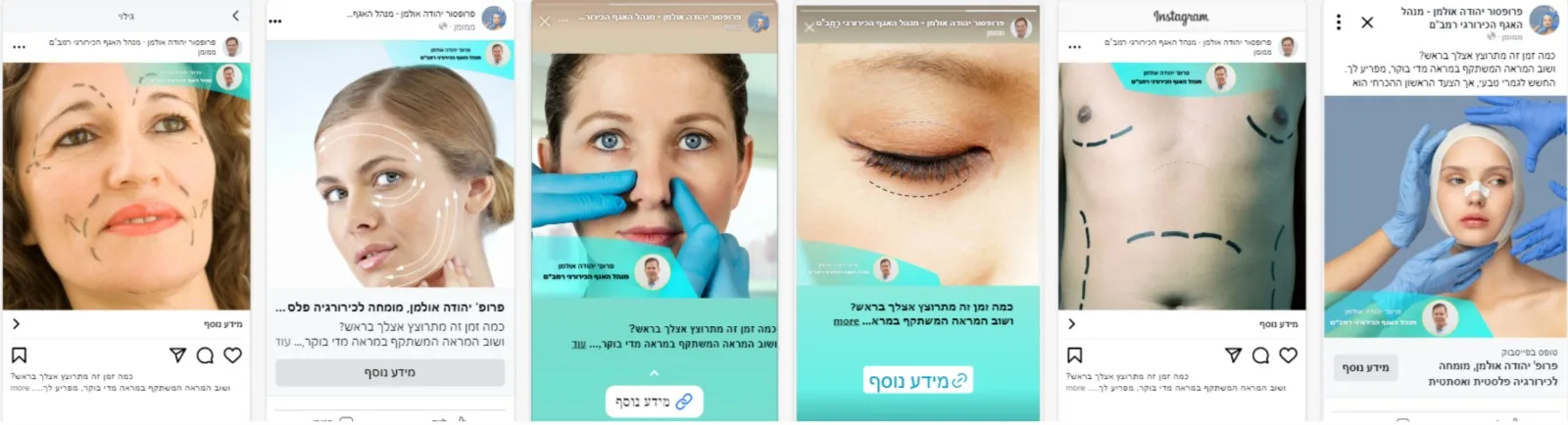 פרסום - דוגמה
