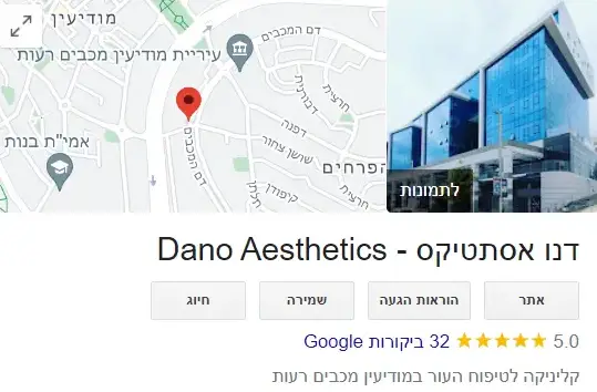 כרטיס GMB חלק עליון - דוגמה